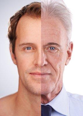 Botox and Fillers for Men and Women