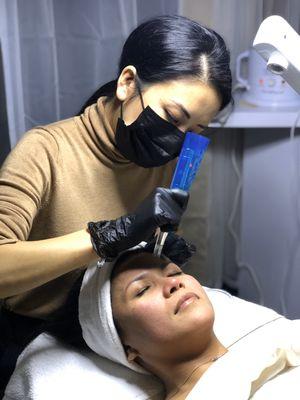 Nanoneedling in the Bliss Treatment