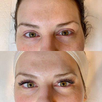 Before + after of a full set of lashes and chemical peel!