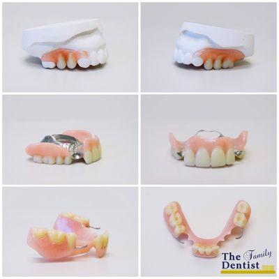 Partial dentures for all kind of needs and desires!