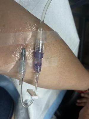 IV