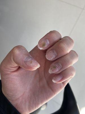 My nails when I remove the acrylic nail