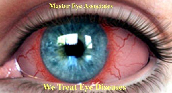 We are pink eye infection experts.