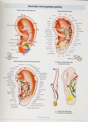 Ear acupuncture for weight loss, PTSD, anxiety and pain