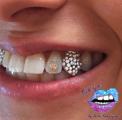 Disco Tooth with a yellow gold Chanel drop