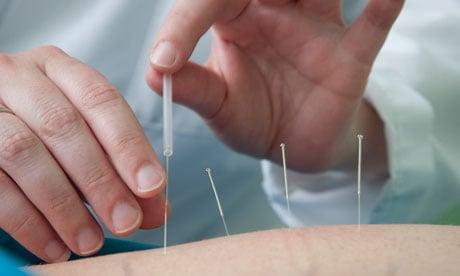 Acupuncture