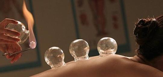 Cupping therapy to ease muscle aches and clear up energy blockages