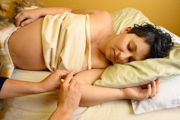 Acupuncture in pregnancy alleviates morning sickness, helps with round ligament pain, heartburn, constipation, swelling, carpal tunnel etc..