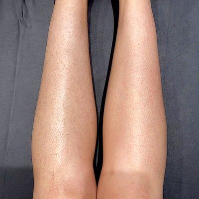 Full leg sugaring before (left) & after (right)