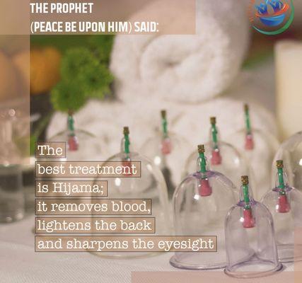 Hijama cupping removes toxins from the body and helps the body with pain and inflammation.