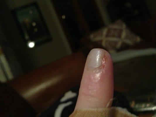 My nail after manicure. Been going here for 5+yrs but never again. My finger has been throbbing for days&dr had to call in meds