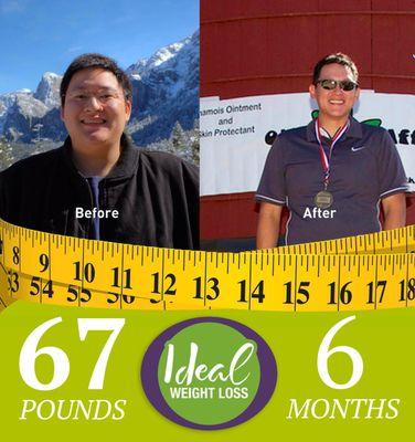 Fresno Weight Loss