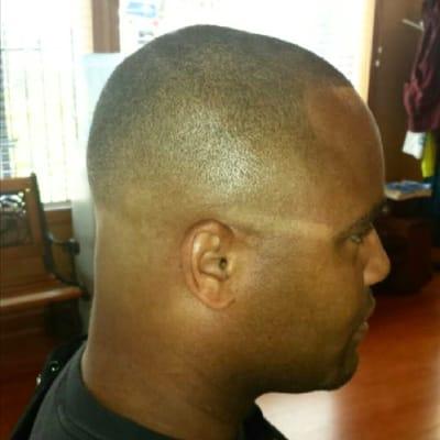 Bald fade