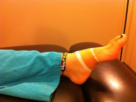 Athletic taping of feet