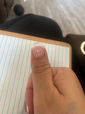 Cut my nails so short you can see my thumb on the other side