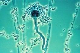 Aspergillus is frequently found in air and soil, it flourishes in decaying vegetation, foods, dusts, and water.