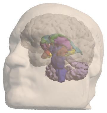 i3D file showing the head, brain and other stuff.