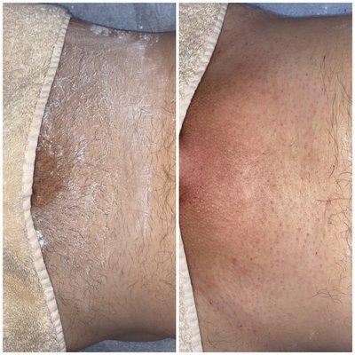 Male Brazilian Wax