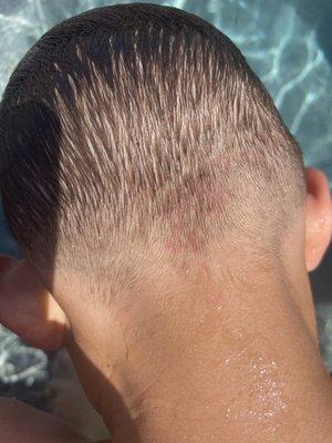 The pinch marks from the clippers an hour after and after being submerged in water.