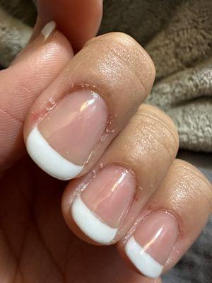 Cuticles that were cut too much and the skin that were sticking out