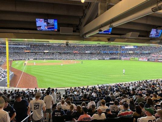 Right field view