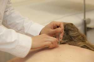 We offer Acupuncture Care by Dr. Mei who has over 40 years of experience.