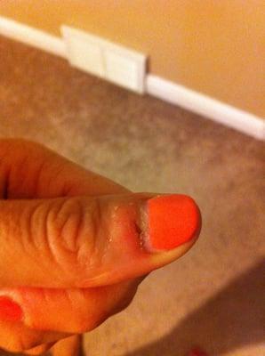 I know this is gross, but I wanted to show what my cuticle looked like after they butchered it. This pic goes along w/ my review