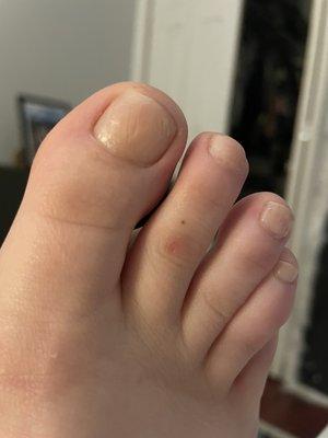 Half painted toe?