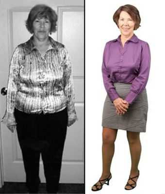 Judy lost 27 pounds and went from a Size 14 to a Size 4! “I came into the office wearing a size 14. I felt horrible, but since then, there h