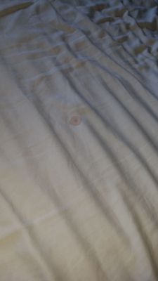 Blood stain on the sheets   The worst  experience ever .indian man disrespectful and didn't care