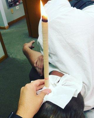 Ear candling, one of the treatments that we do at our office