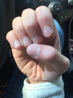 This is what they did to my nails. I received acrylics 4 days ago and they chipped and broke immediately.