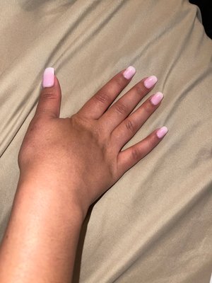 Bulky nails and uneven