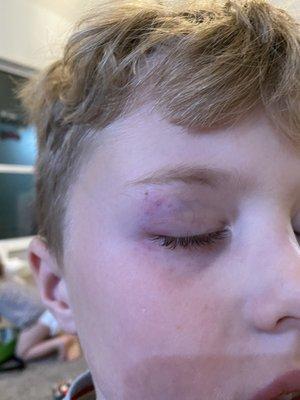 Sons black eye due to neglect in safety measures