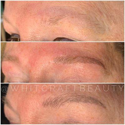 Before, Immediately After & Healed Microblading