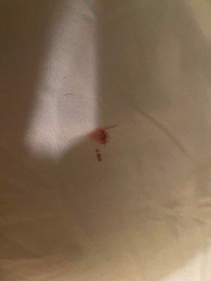 Blood on bed. obviosly not fresh and was not put there by anyone in the room.