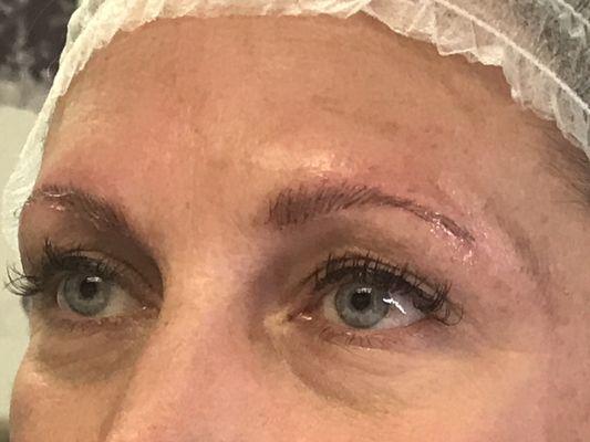 After the Microblading