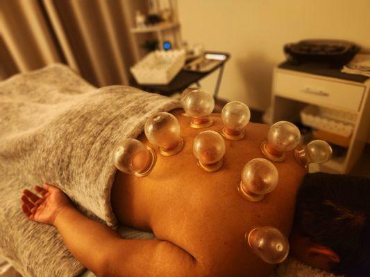 Fire cupping