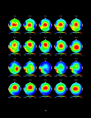 Brain maps help us understand how your brain is working. We use maps to develop custom training program to help your brain function better.