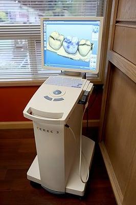 Digital CAD/CAM technology allows us to create ceramic crowns in just one single visit (without impressions or temporaries)