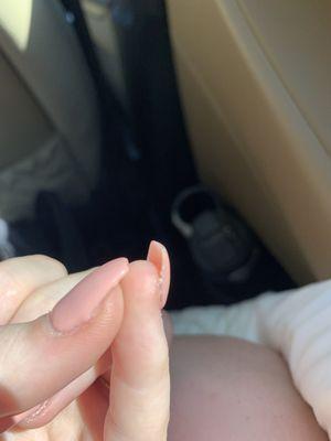 Clump of acrylics under pinky nail