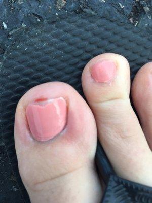 Red swollen nail