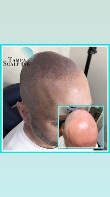 Before and after of this customers scalp micropigmentation. Make yourself look younger with SMP .