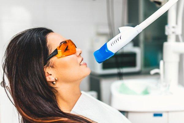 laser teeth whitening