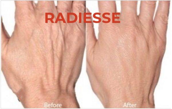 Rejuvenate Hands!