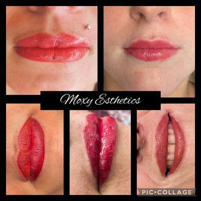 Lip blush results