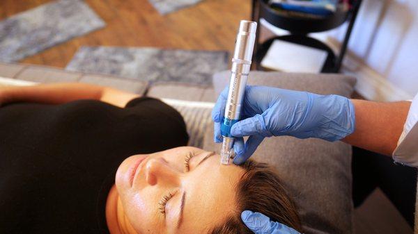 Certified in Traditional Chinese Cosmetic treatments and Micro-needling techniques