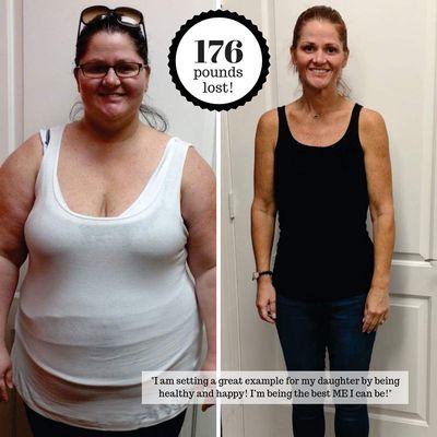 Jennifer lost 176 pounds using the Ideal Protein Weight Loss Protocol!