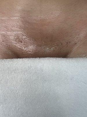 Brazilian Wax