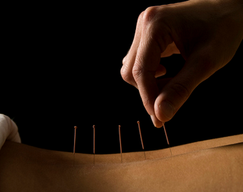 Five Element Acupuncture